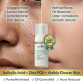 BioBrite face wash ingredients – Salicylic Acid, 
Zinc PCA, Tea Tree Oil – Senoras India